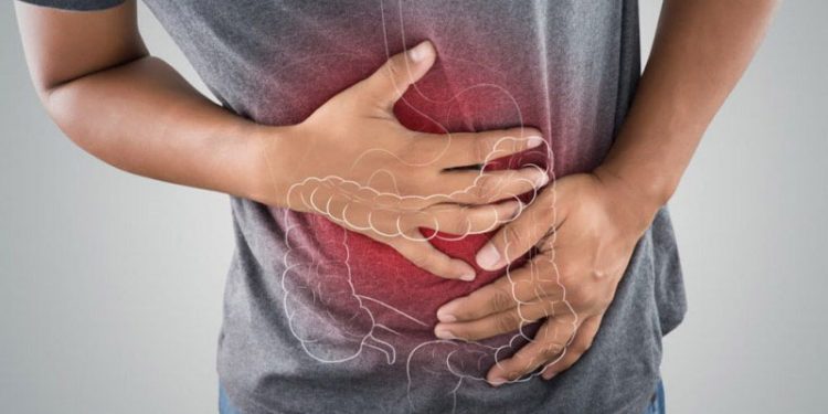 The 5 Silent Symptoms of Colon Cancer