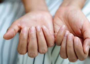 Get Checked for Cancer if You See This on Your Fingernails 