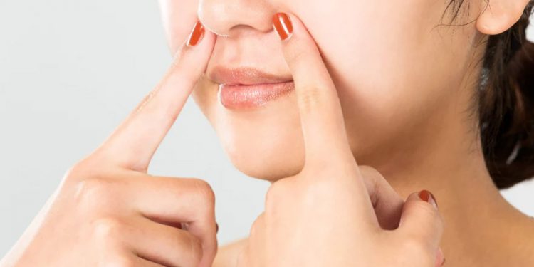 Got Blackheads on Your Nose? Here’s How to Remove Them  