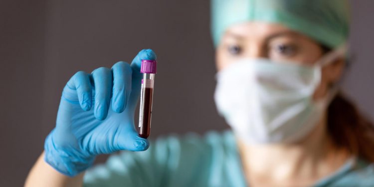 Having This Blood Type Can Increase Your Chances of a Heart Attack!