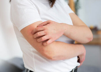 CDC Warns of Public Health Threat: Spreading Skin Infection