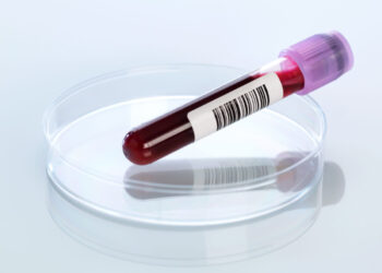 This New Blood Test Can Detect Risk for Alzheimer’s!