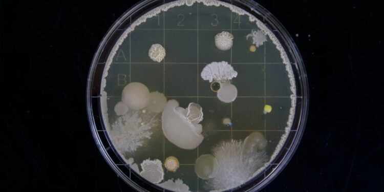 Quick Tips to Dodge These Flesh-Eating Bacteria
