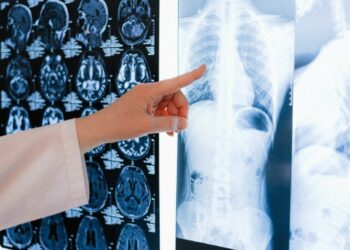 11 Alarming Indicators of Lung Cancer You Must Be Aware of