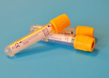 The Top Five Laboratory Tests You Need to Undergo Before 2024