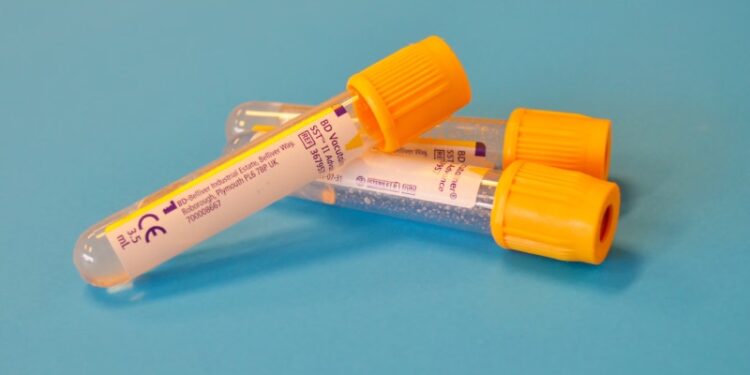The Top Five Laboratory Tests You Need to Undergo Before 2024