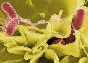 Symptoms of the Salmonella Outbreak That Spread in 34 States