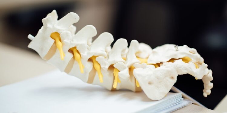 SPINAL STENOSIS DIAGNOSIS TREATMENT AND STEPS TO TAKE intelligence overview