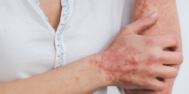 Compilation of 11 Adult Skin Problems Widely Spread Among People
