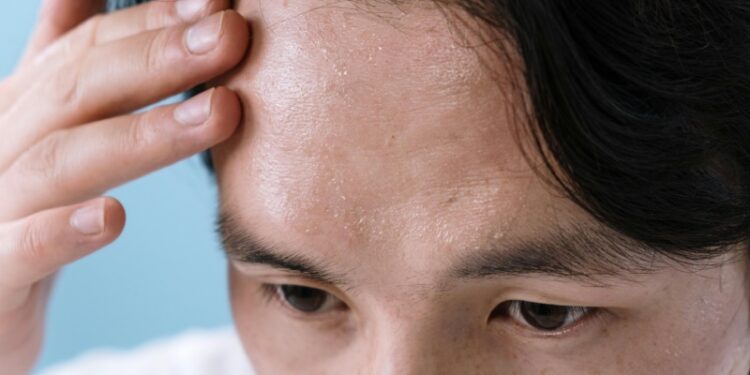 The Primary Symptom of Mini Strokes That Most People Overlook