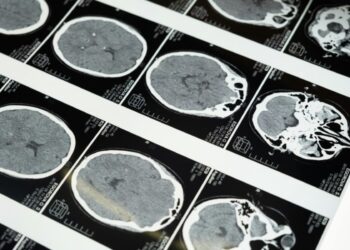 The 3 Most Prevalent Symptoms of a Brain Parasite Attack