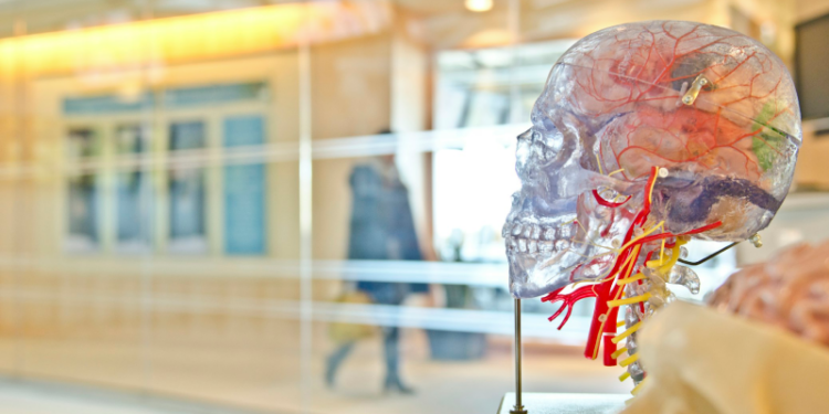 7 Methods to Prevent a Stroke Naturally