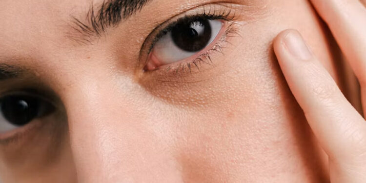 If One Pupil Suddenly Looks Bigger Than the Other, Call 911 Immediately
