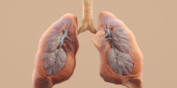 The First Sign of a Blood Clot in Your Lung